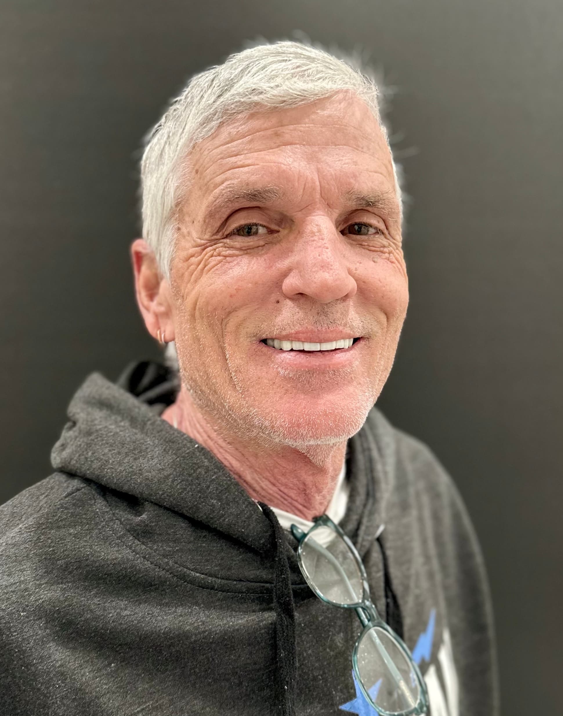 John after Fixed full-arch implants at Southern Smiles