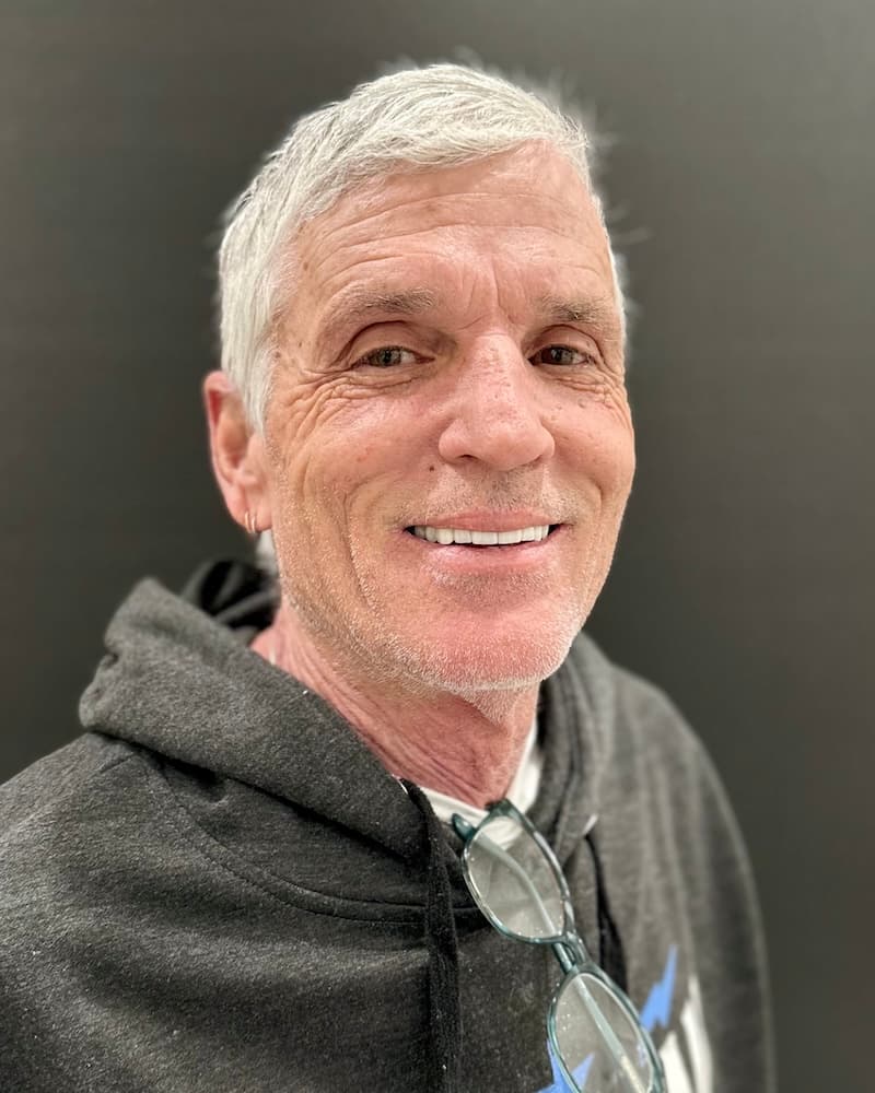 John after All-on-4 implants at Southern Smiles